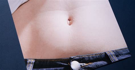 Yeasty Belly Button