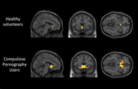 Your Brain On Porm