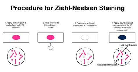 Zn Staining Procedure