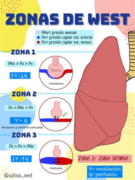 Zonas De West
