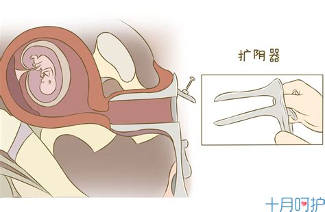 清宫手术的过程图片