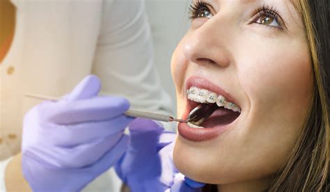 ﻿cómo convertirse en ortodoncista en canadá